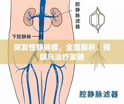 突发性静脉瘘,全面解析、预防与治疗策略